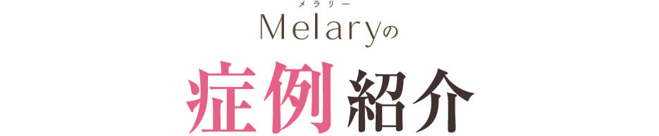 ビフォーアフター