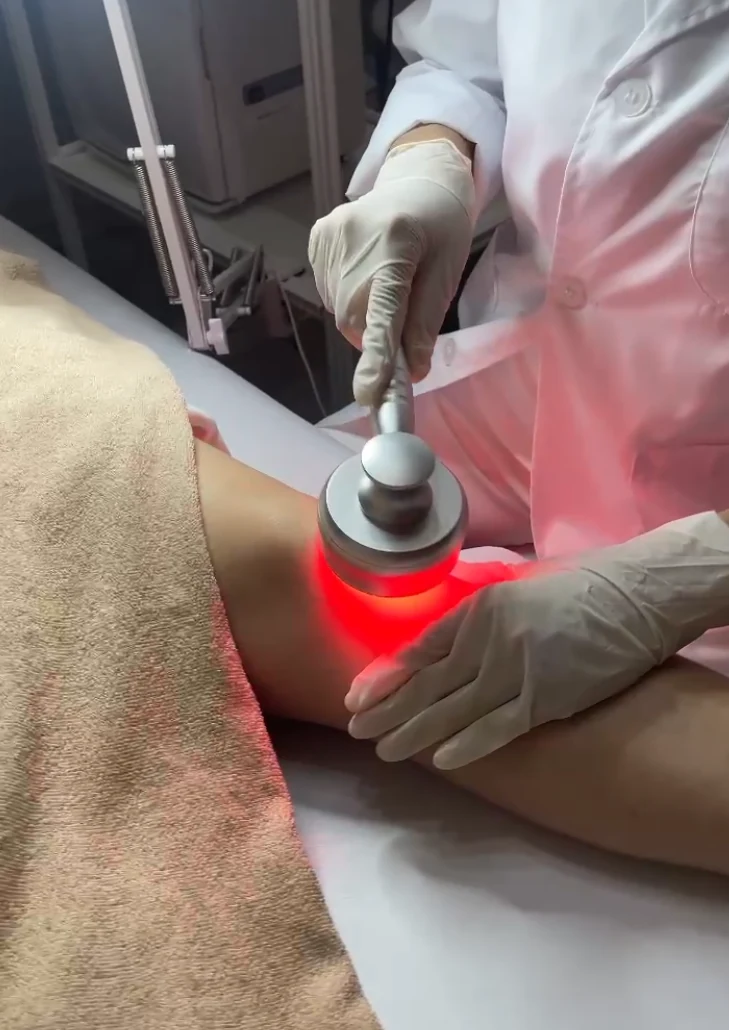 赤色LEDを使ったメラニンケアの様子